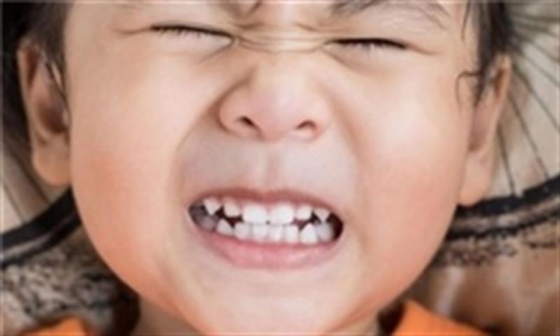 علل دندان قروچه در کودکان/ راه پیشگیری از سایش دندانی