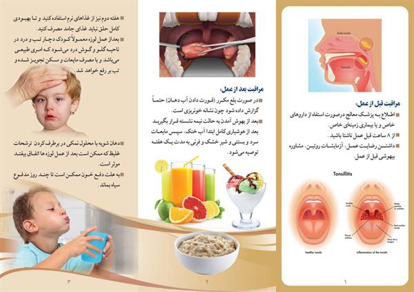 جراحی لوزه2