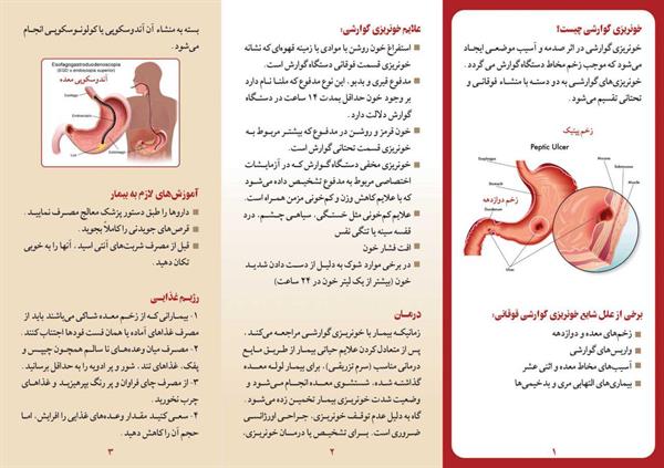 خونریزی گوارشی 2