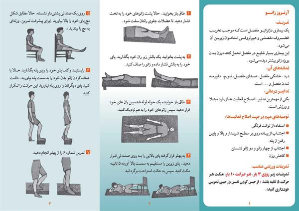 آرتروز زانو2