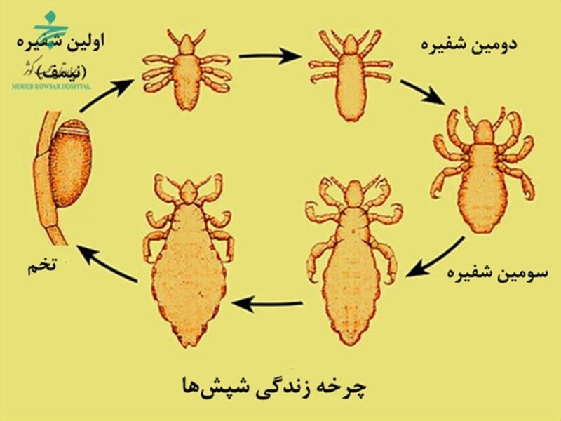 شپش بیماری این روزهای مهدهای کودک