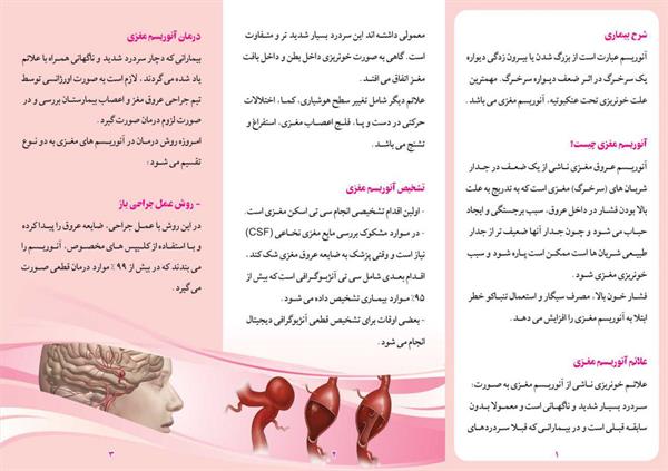 آنوریسم مغز2