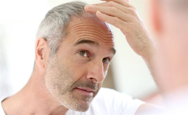 زراعة الشعر مع دكتور دائر