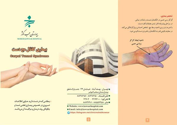 کانال مچ دست