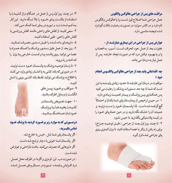 هالوکس والگوس2