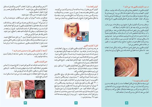 کولونوسکوپی