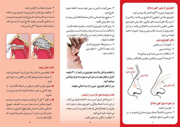 خونریزی از بینی (2)