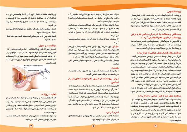 پروستاتکتومی2