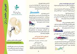 تعویص مفصل ران 2