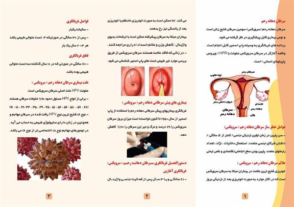 سرطان دهانه رحم