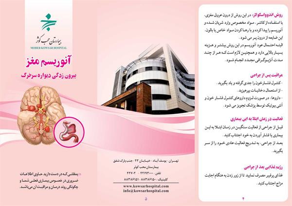 آنوریسم مغز