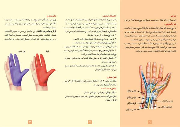 کانال مچ دست 2