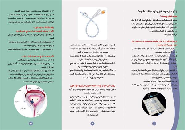 سوند فولی (2)