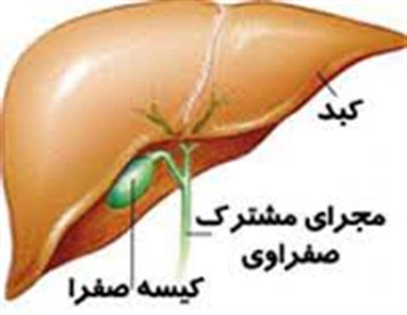 برداشتن «کیسه صفرا» چه عوارضی به دنبال دارد؟