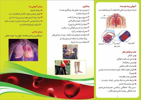 آمبولی ریه 2