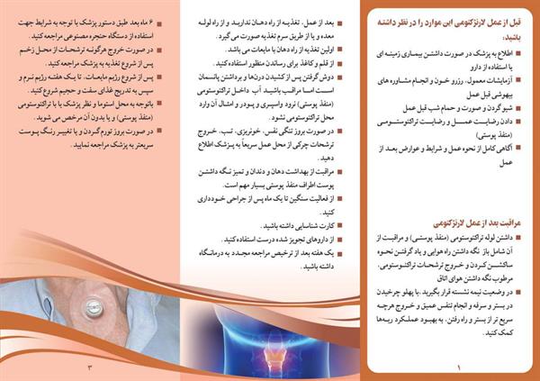 تراکئوستومی (2)