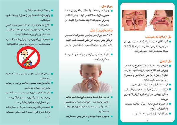 آندوسکوپی سینوس2