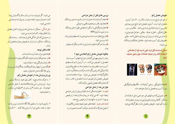 تعویض مفصل زانو