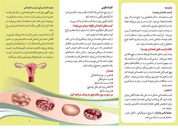 کیست تخمدان