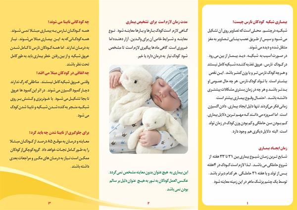 رتینوپاتی نوزادان نارس 2