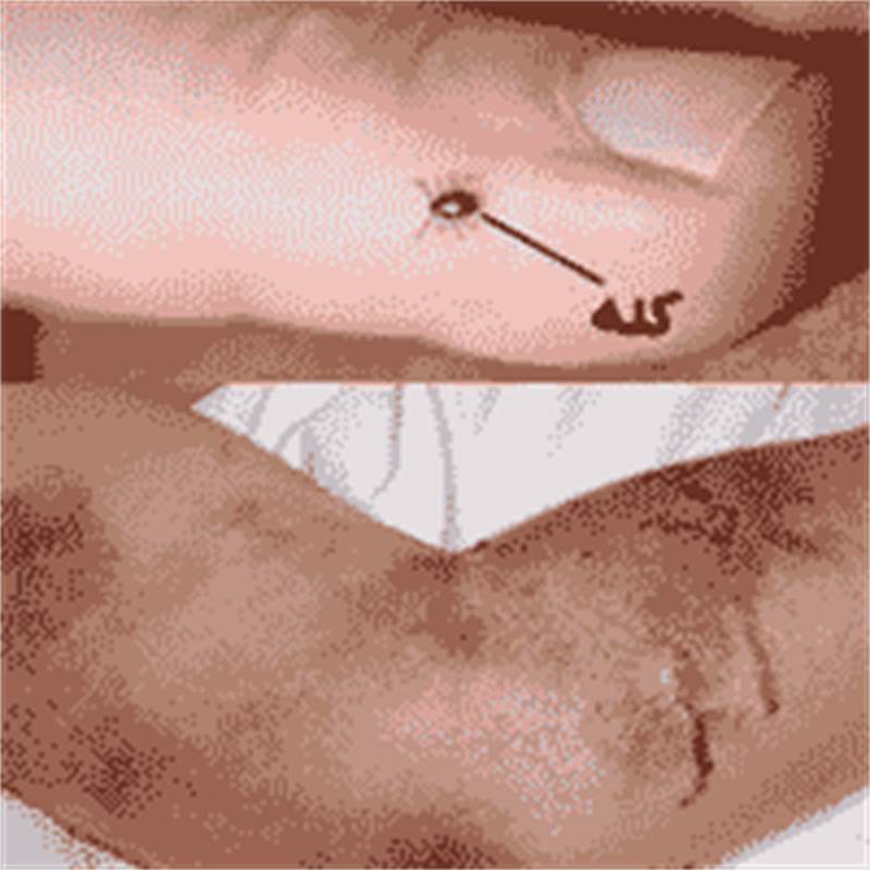 از نگهداری کله و پاچه تمیز نشده خودداری کنید/ احتمال شیوع تب کریمه کنگو از دام‌های قربانی شده در محرم