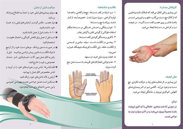 کارپانتال سندرم