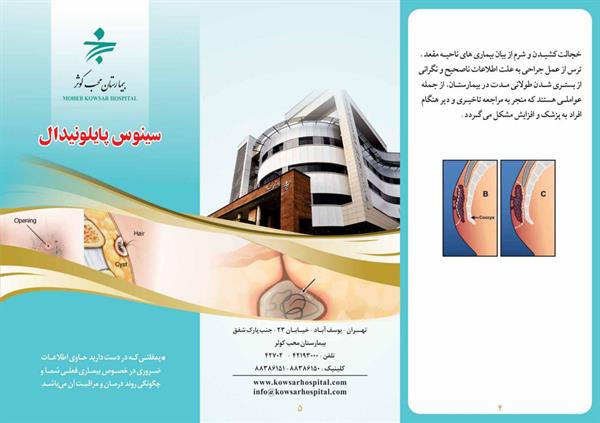 سینوس پایلونیدال